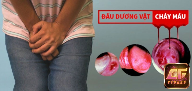Ngủ mơ thấy dương vật chảy máu thể hiện những băn khoăn, nỗi khổ tâm của bạn ở hiện tại