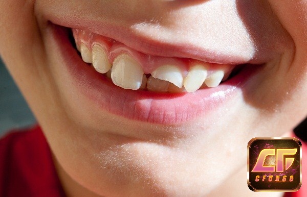 Mơ thấy gãy răng đánh số gì cho hiệu quả trong lô đề?